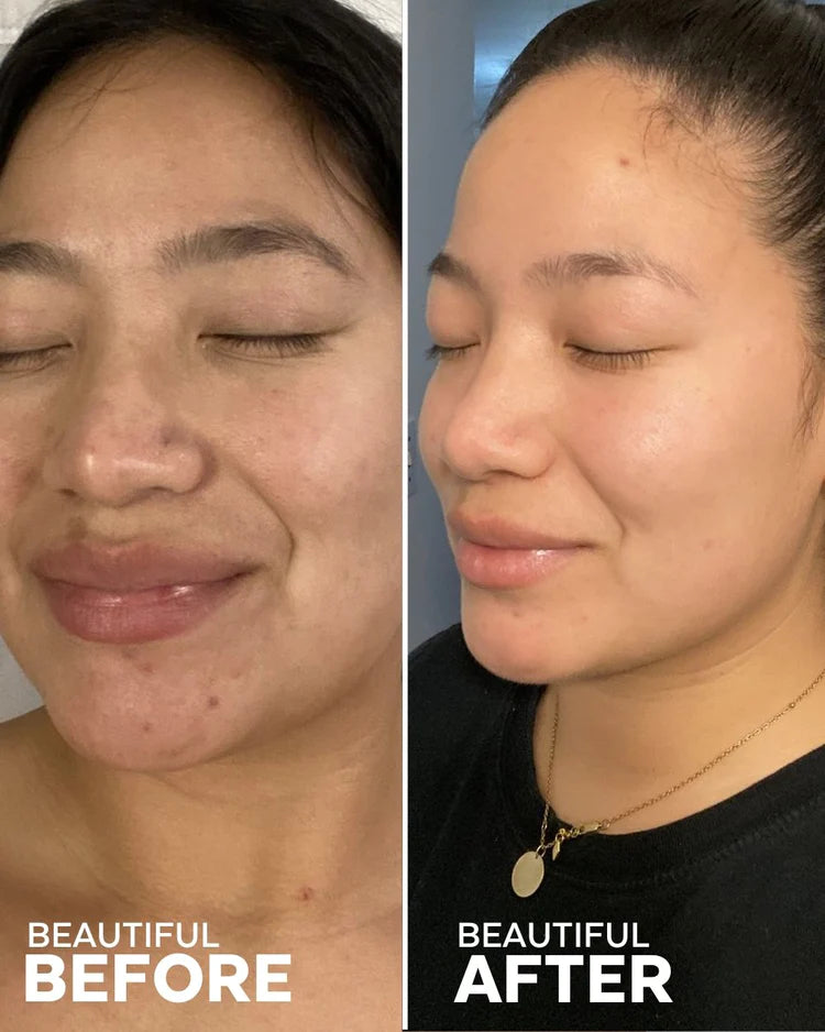 Can Dew 3-Step for Glowing Skin Kit