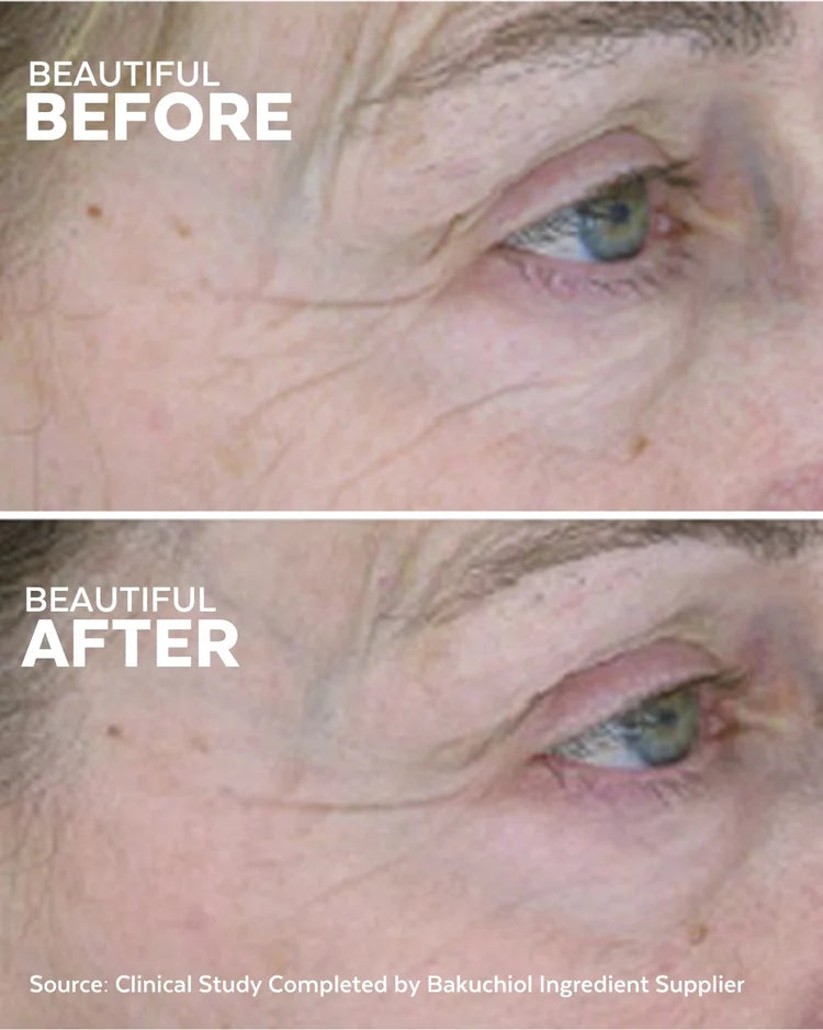 Skin Hero Bakuchiol + Calendula Bio-Retinol Serum